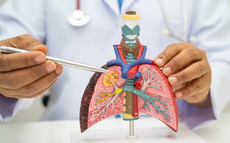 Guatemala incorpora nuevos servicios especializados para el cuidado de enfermedades respiratorias